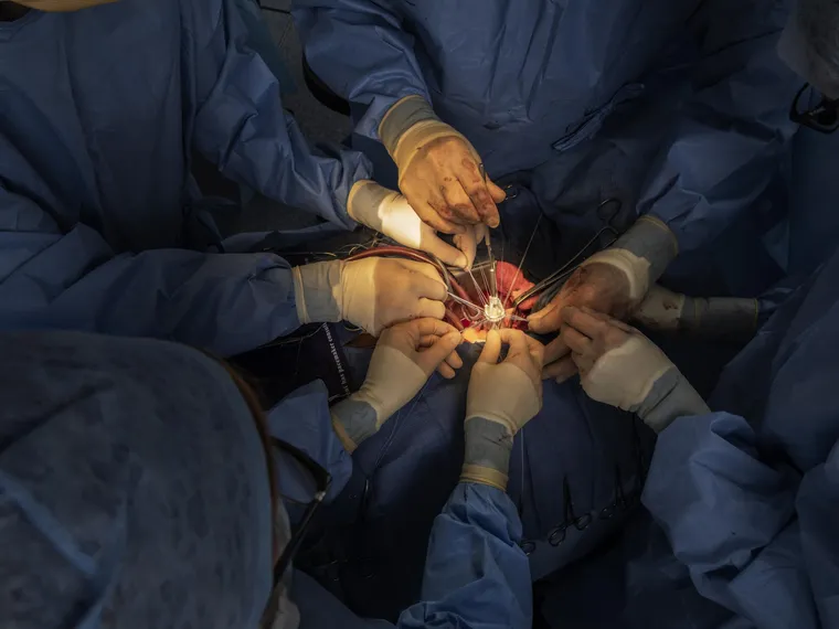 taxa de sucesso transplante cardíaco