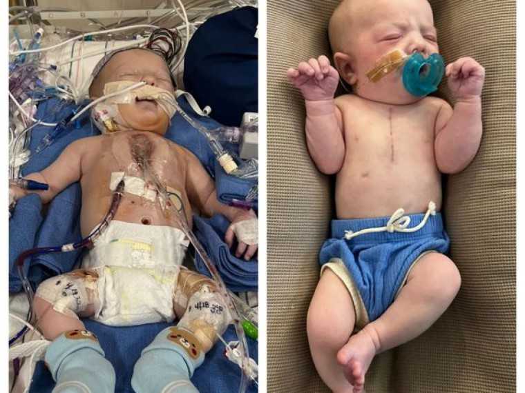 recuperação após transplante de coração