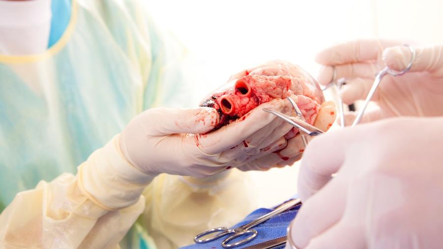 recuperação após transplante de coração