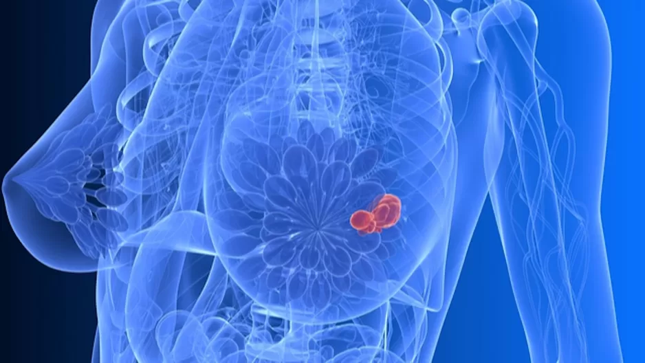 diagnóstico de câncer por imagem