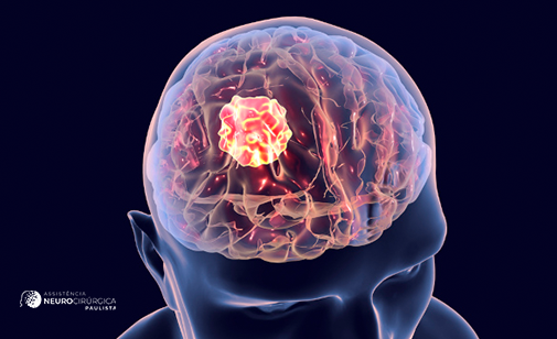 biópsia para confirmação de tumor