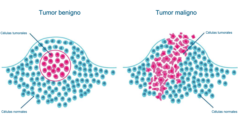 diagnóstico de câncer por imagem