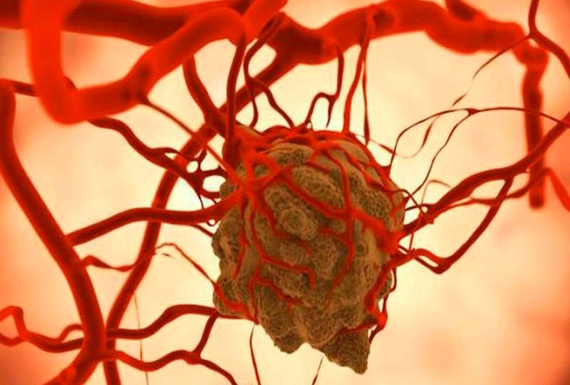 sinais de tumor maligno