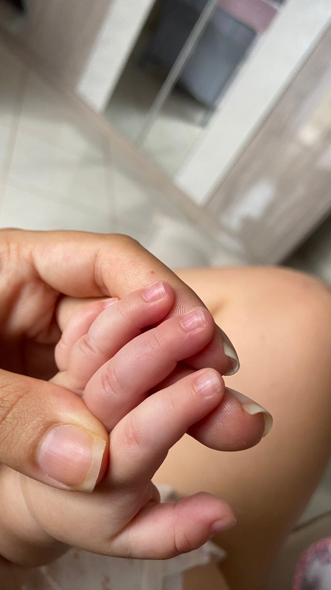 Unhas Onduladas: Sinais do Seu Corpo e Soluções Eficazes