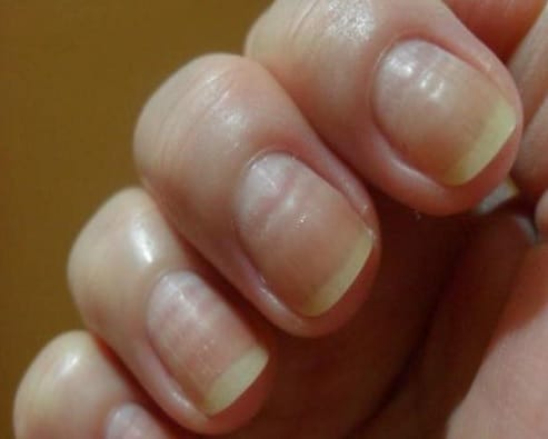 Manicure Correta: Evitando Traumas e Ondulações nas Unhas
