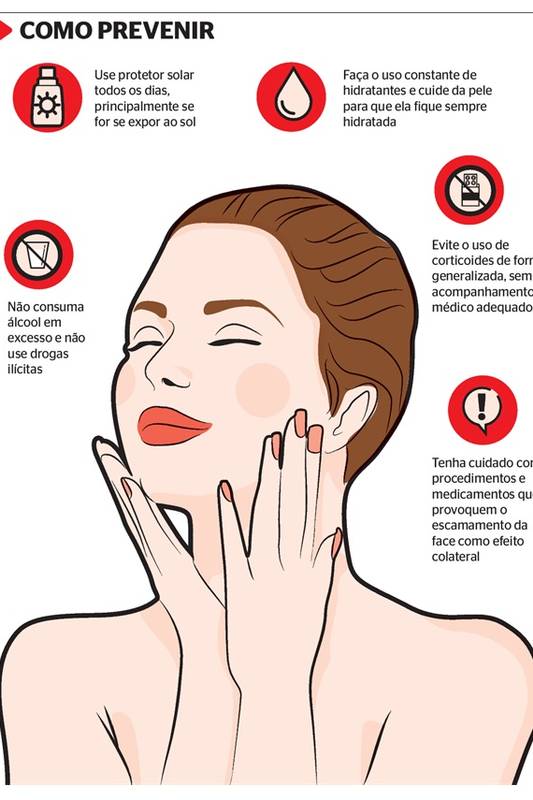 Vasinhos No Rosto Porque Surgem E Como Prevenir