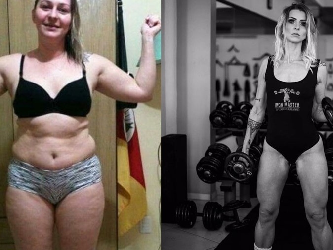celulite glúteo antes e depois