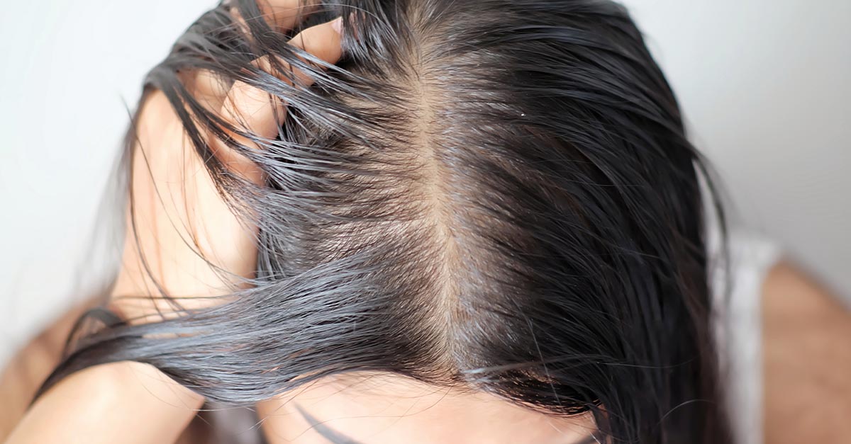 como disfarçar cabelo sujo solto