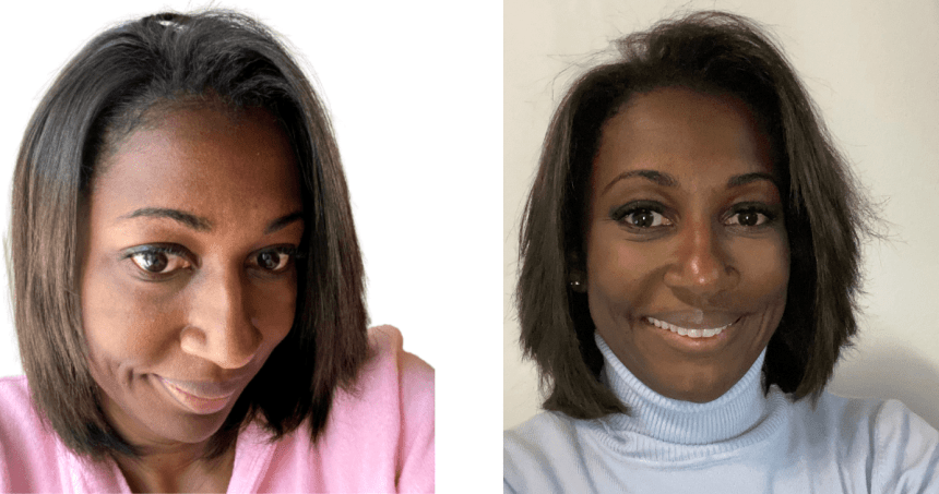 quanto tempo demora para o cabelo crescer 4 dedos